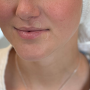 Lip Care Patch – 48 Hydrocolloid Patches with Tea Tree Oil