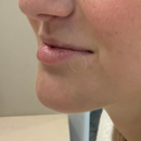 Lip Care Patch – 48 Hydrocolloid Patches with Tea Tree Oil