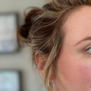 Microneedle Blemish Patch – 9 Patches with Salicylic Acid and Tea Tree Oil